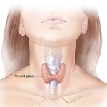 Thyroid. NIH image.
